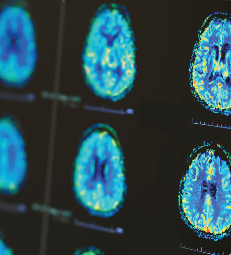 TAC cervello TAC cervello